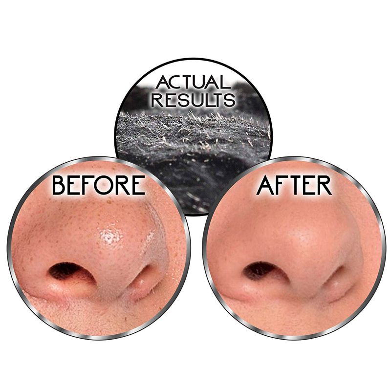 Máscara Limpeza Facial - Skin Care Remover Cravos e Espinhas 82 ml